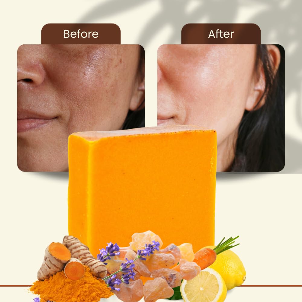 Turmeric Skin Cleansing Soap - Natural Glow Face & Body Cleanser for Acne, Dark Spots & Scars, Gentle for All Skin Types (4.5 oz) 1 bar - Image 7
