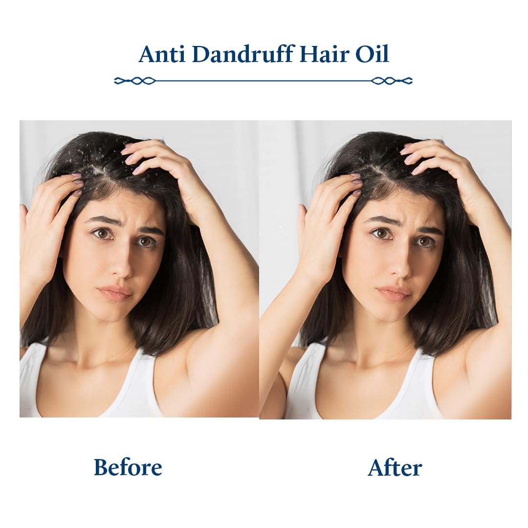 Blue Nectar Tea Tree Oil for Hair | Natural Anti Dandruff Oil for Scalp | Ayurvedic Plant Based Neem Amla Hair Oil (12 Herbs, 3.38 Fl Oz) - Image 4