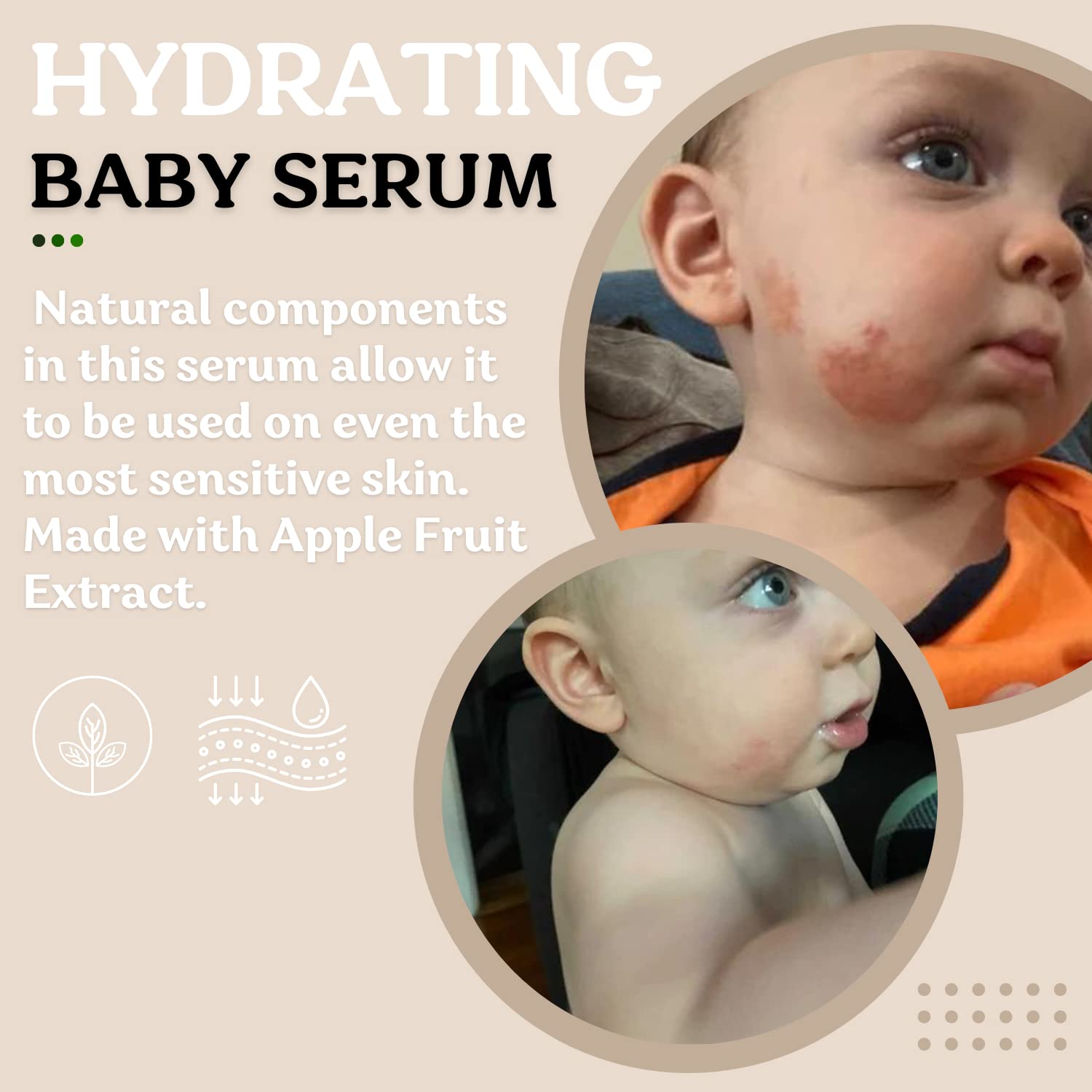 Roe Wellness- Baby Serum Hydrating Skincare Probiotic Protection | Hydrate, Soothe, Clean Ingredients & Safe For All Skin Babies, Infants, Toddlers & Kids (Power Serum) - Image 2