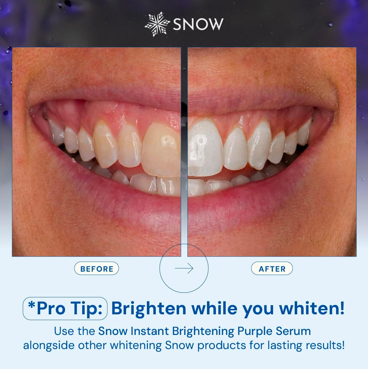 SNOW Teeth Brightening Purple Serum | Gentle & Enamel Safe Instant Brightening for Brighter Smile | Dental Care, Hygiene, & Tooth Care Bright Smile for Events Daily Confidence 2 Month Supply - Image 6