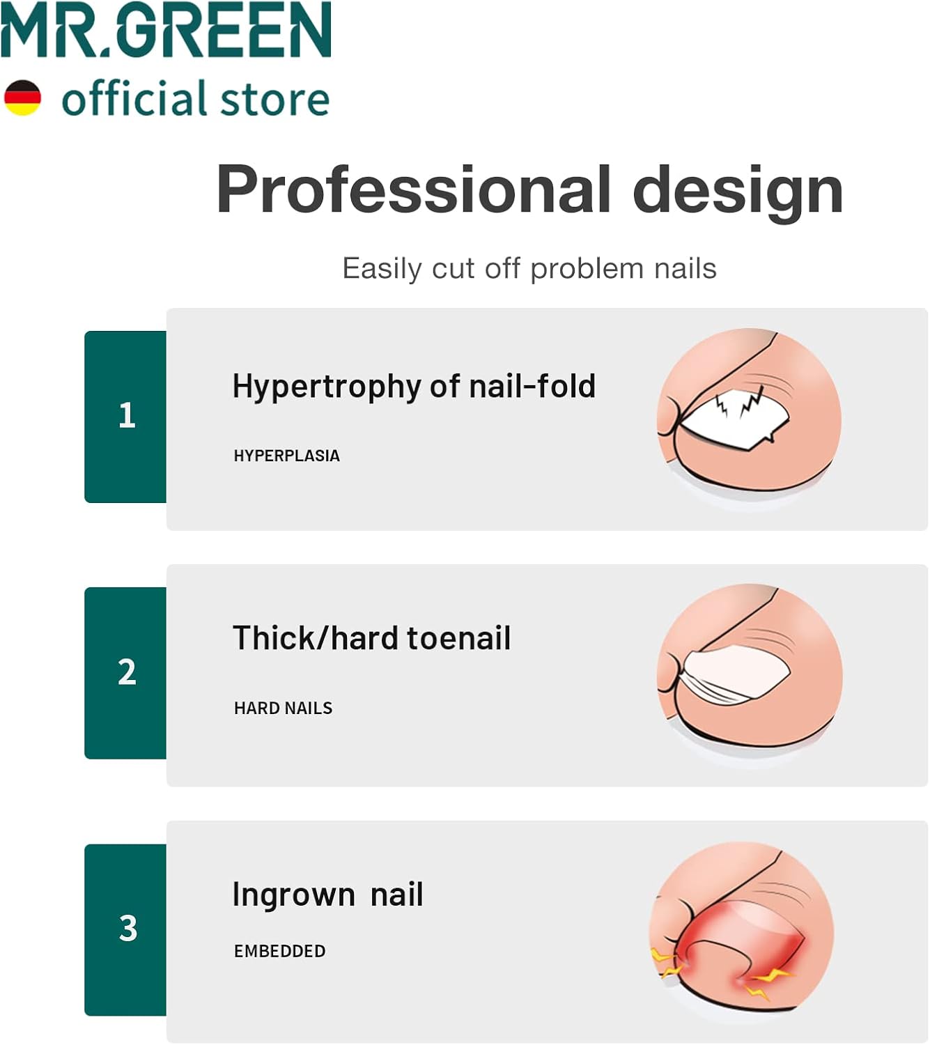 MR.GREEN Stainless Steel Toenail Clippers for Thick Hard Nails Pedicure Tool Green - Image 3
