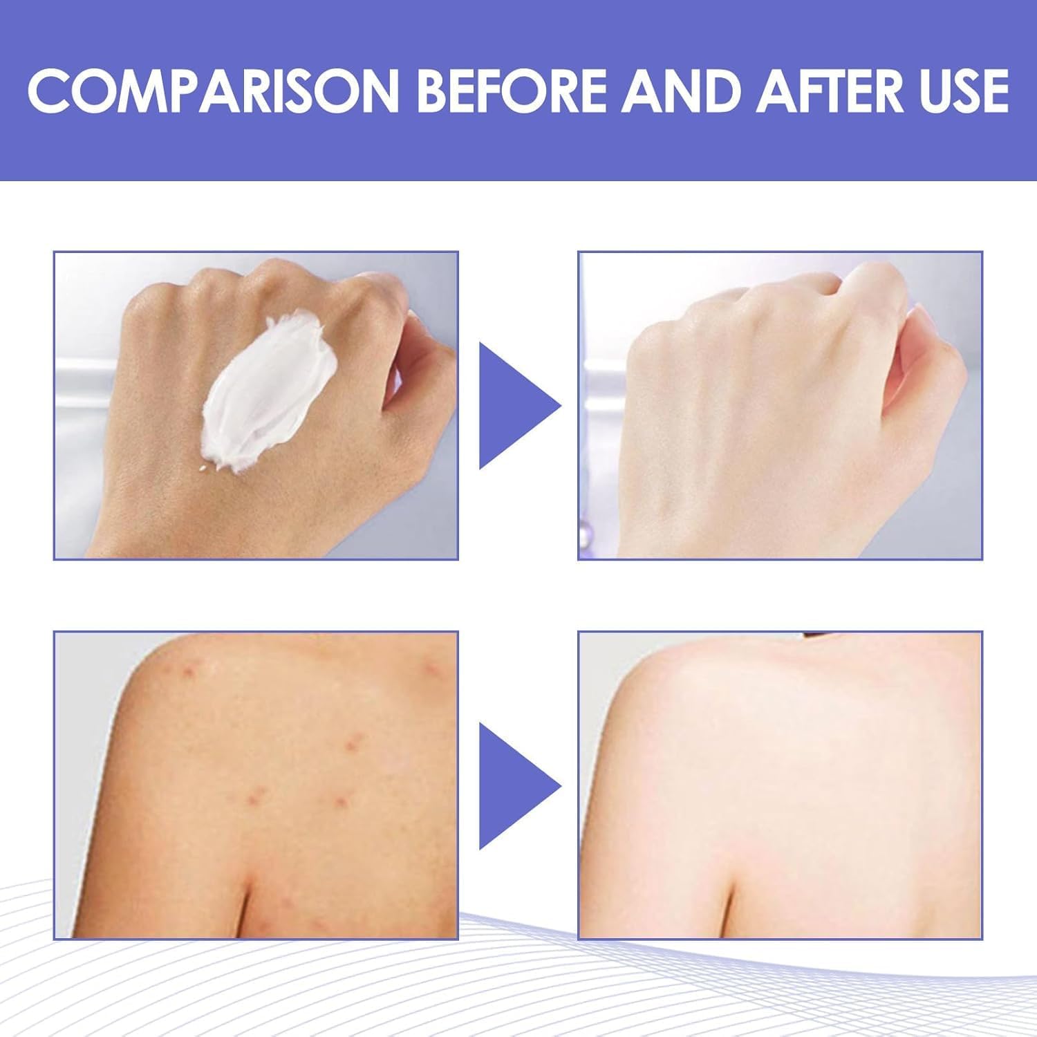 Intimate Skin Brightening Cream for Women Dark Spots Underarms Thighs Face 2.0 FL.Oz - Image 6