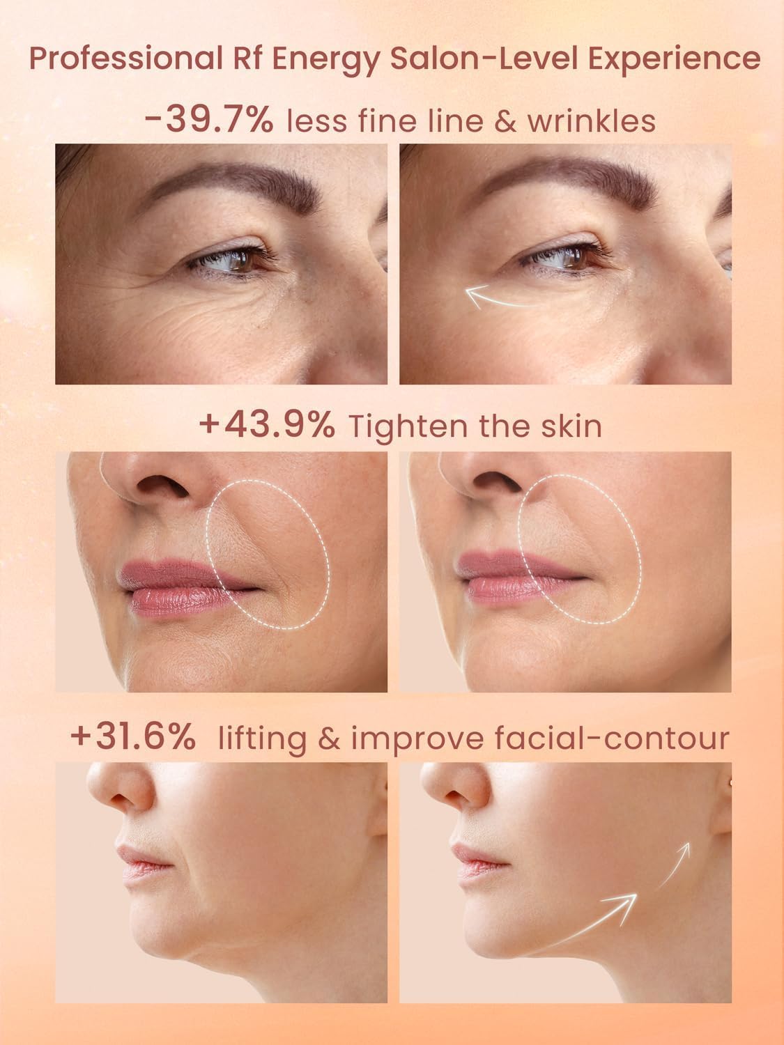 Radio Frequency Skin Tightening Device, Anti-Aging Face Machine for Wrinkle Removal, Lifting & Firming, Wireless Home Beauty Device with 3 Levels, at-Home Skin Renewal - Image 3