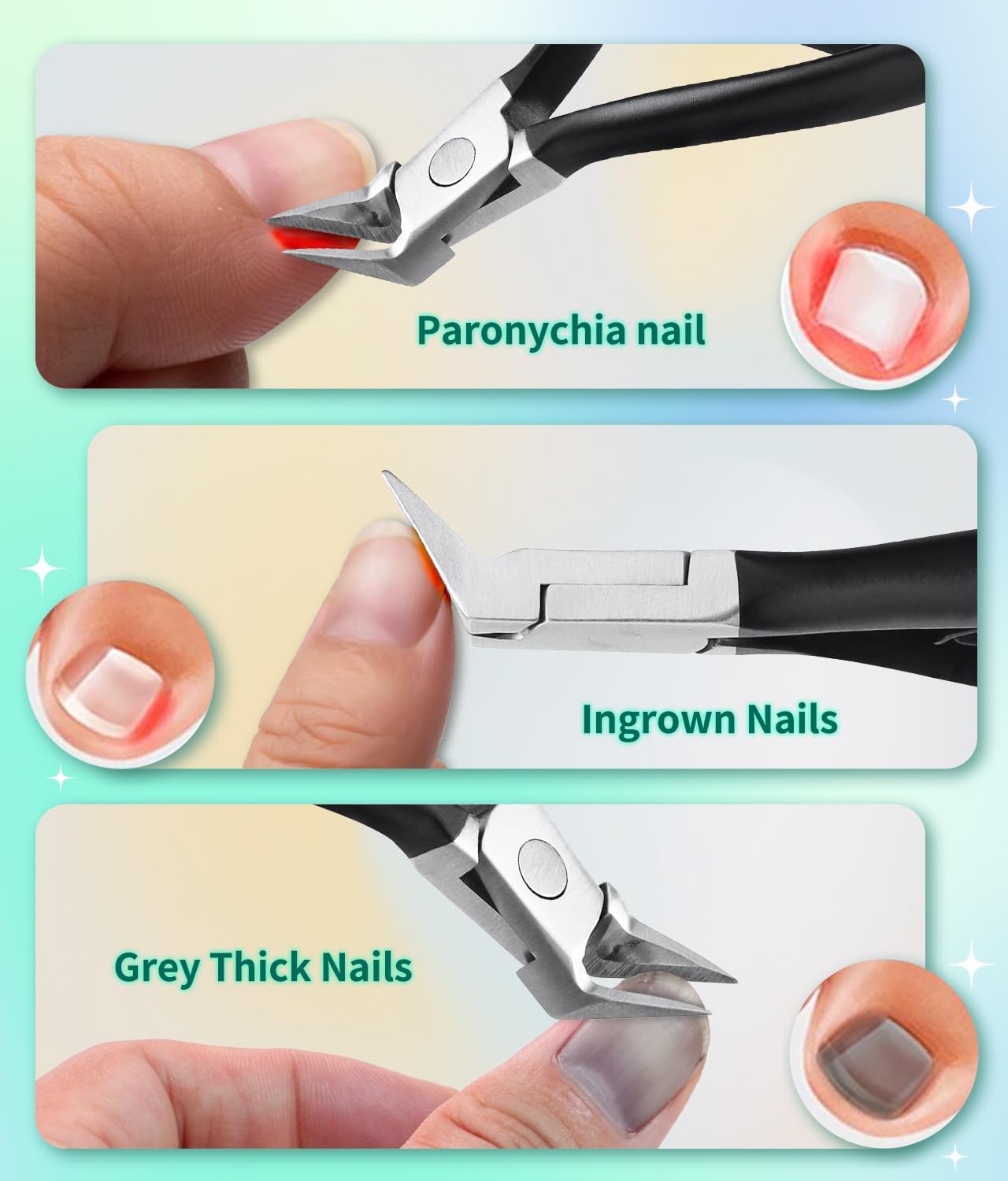 Straight Slanted Ingrown Toenail Clippers for Thick Toenails, Sharp Pointed Tip Toe Nail Cutter, Stainless Steel Heavy Duty Podiatrist Tools for Seniors Men (Black) - Image 3