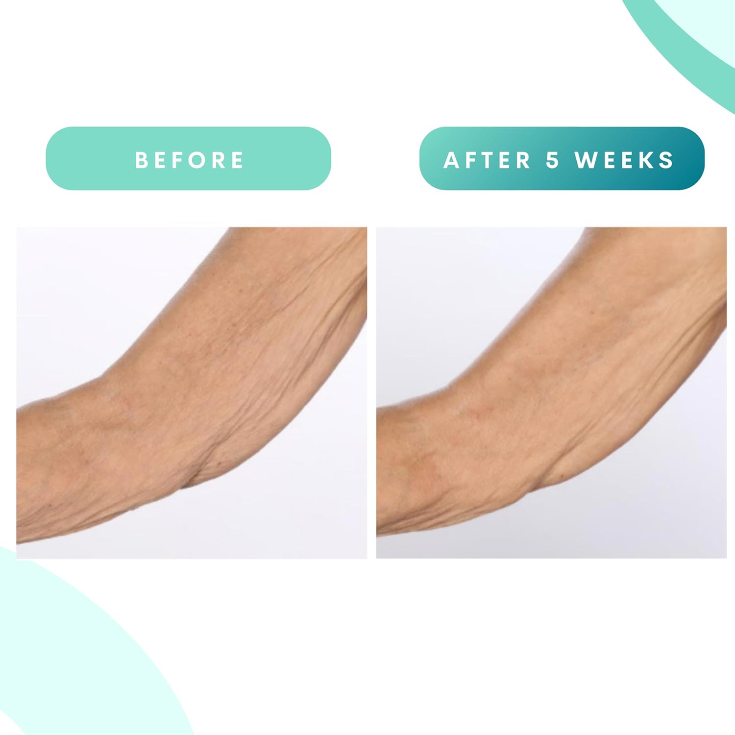 Serious Skincare - Glycolic Firming Retexturizing Body Cream - Moisturizing - Hydrating for Dry Skin - BODY FIT™ - For Crepey and Sagging Skin - Gentle Exfoliation for Smoother Skin - 8 Fl. Oz. - Image 3