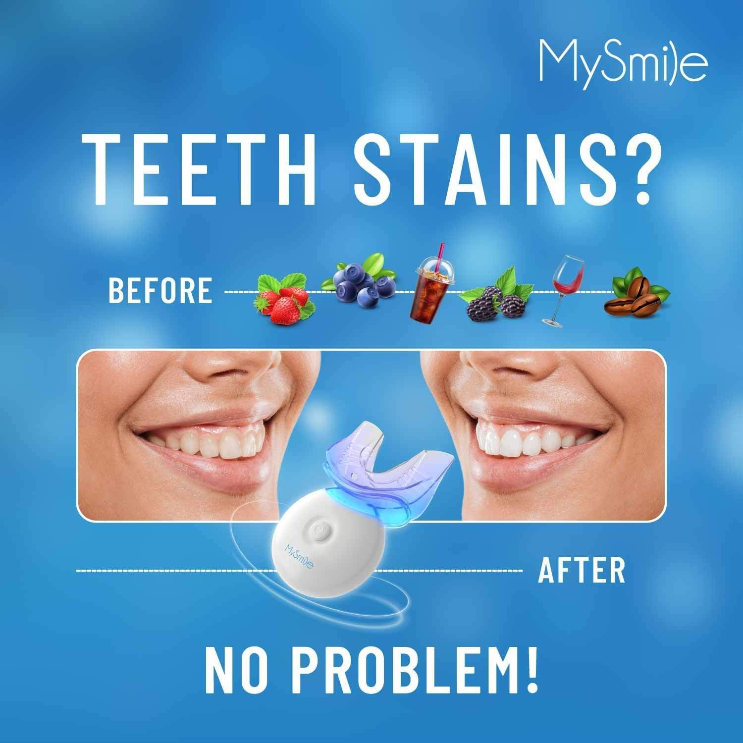MySmile Teeth Whitening Kit with LED Light, 10 Min Fast Teeth Whitener with 3 x 35% Carbamide Peroxide Whitening Gel, Helps to Remove Stains from Coffee, Smoking, Wines, Soda, Food - Image 4