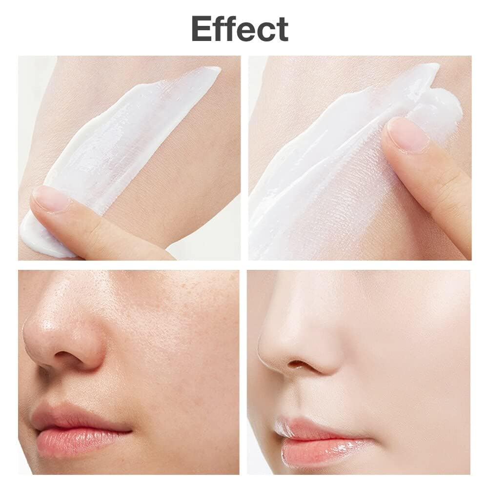 Cystic, Hormonal, Severe Acne Treatment Cream for Teens & Adults with Hyaluronic Acid Aloe Vera Oil Overnight Cystic , Unisex Sensitive Skin Blind Pimple & Blemish Remover (2 PACK) - Image 2