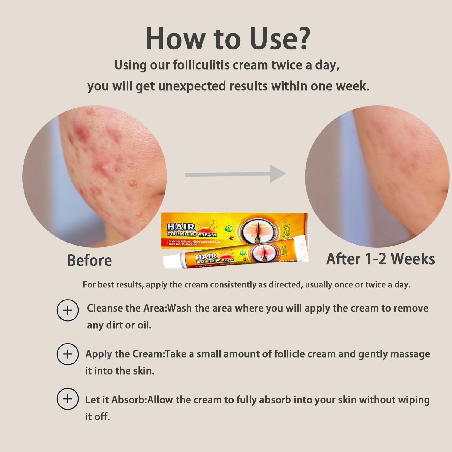 TKTT Folliculitis Cream for Scalp Face Body 1.42 Oz Treats Redness Inflammation - Image 5