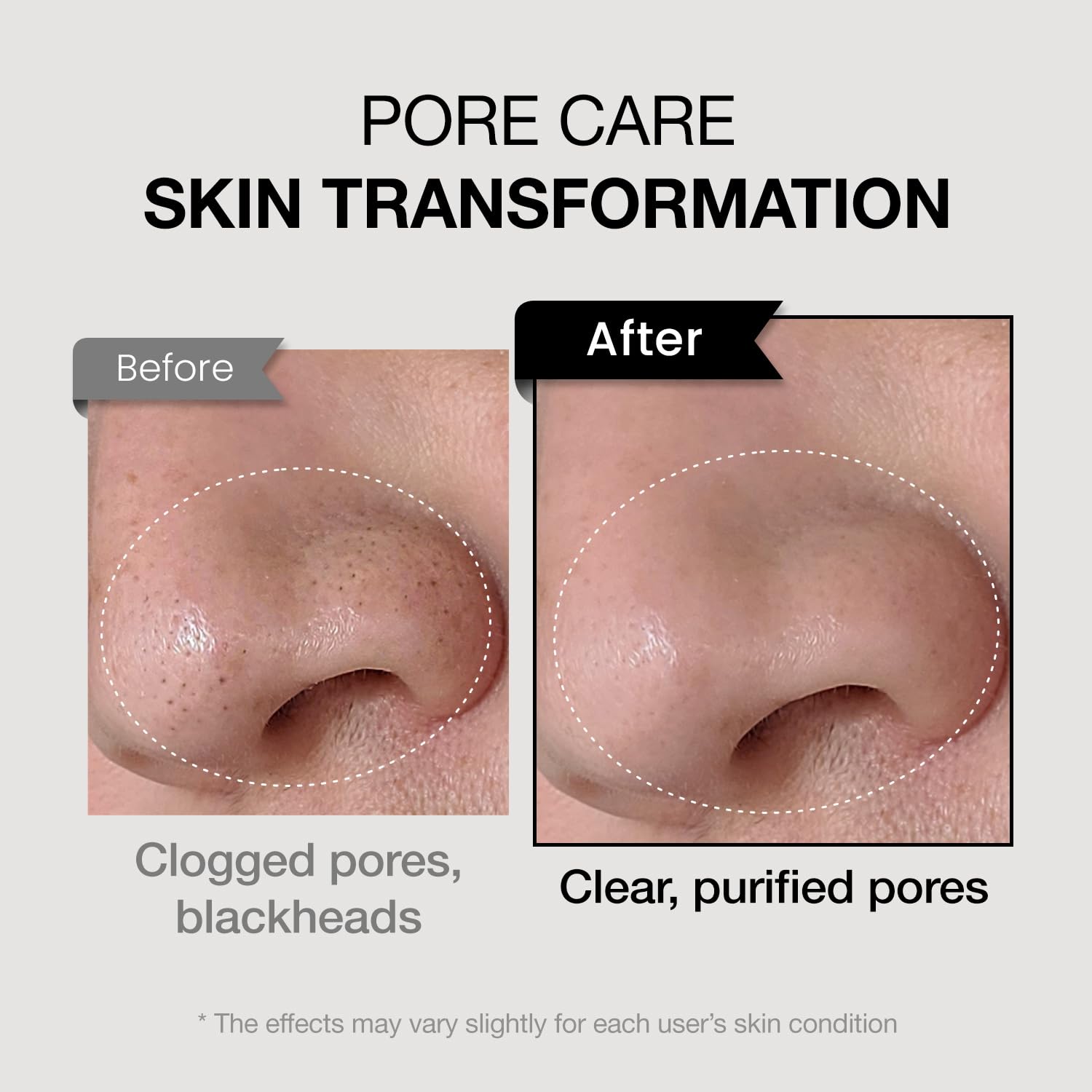Coxir TXA Mucin Pore Mask Cleanser Foam Wash Charcoal Tranexamic Acid 120ml New - Image 6