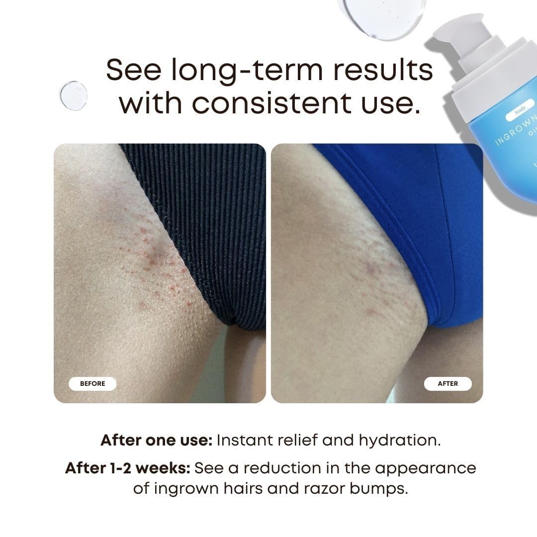 Bushbalm Ingrown Hair Treatment Oil 30ml for Razor Bumps and Soothing Skin - Image 2