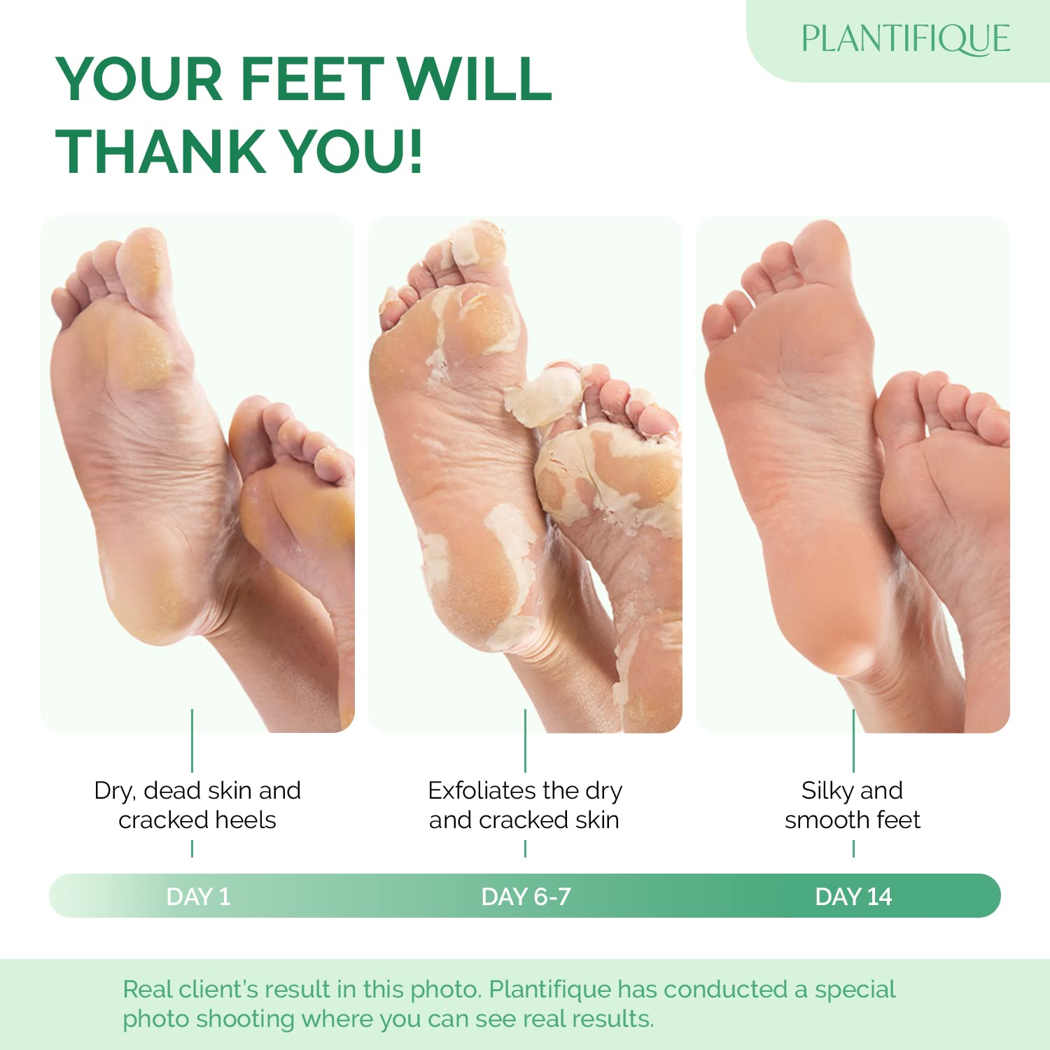 PLANTIFIQUE Peach Foot Peeling Mask 2 Pack for Soft Feet and Heel Repair - Image 2