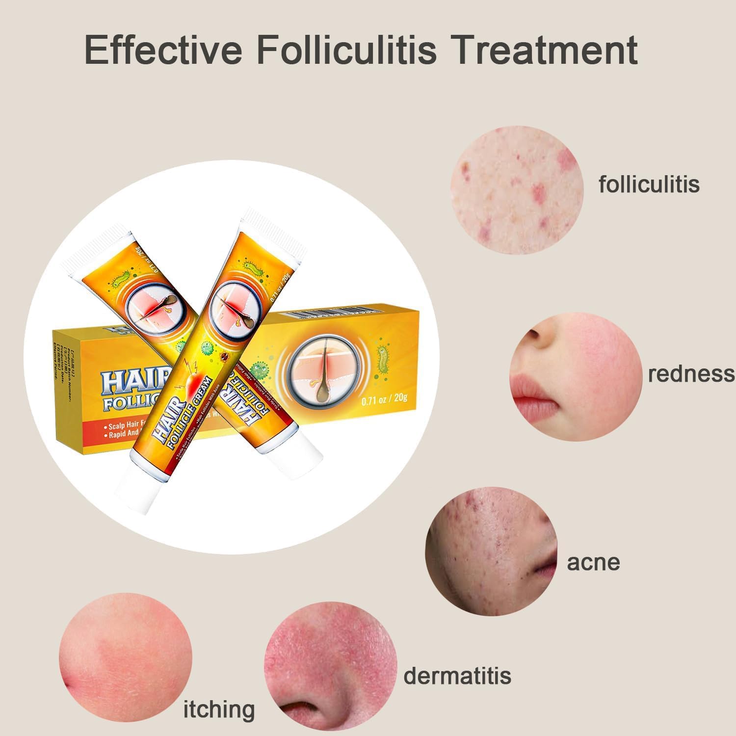 TKTT Folliculitis Cream for Scalp Face Body 1.42 Oz Treats Redness Inflammation - Image 3