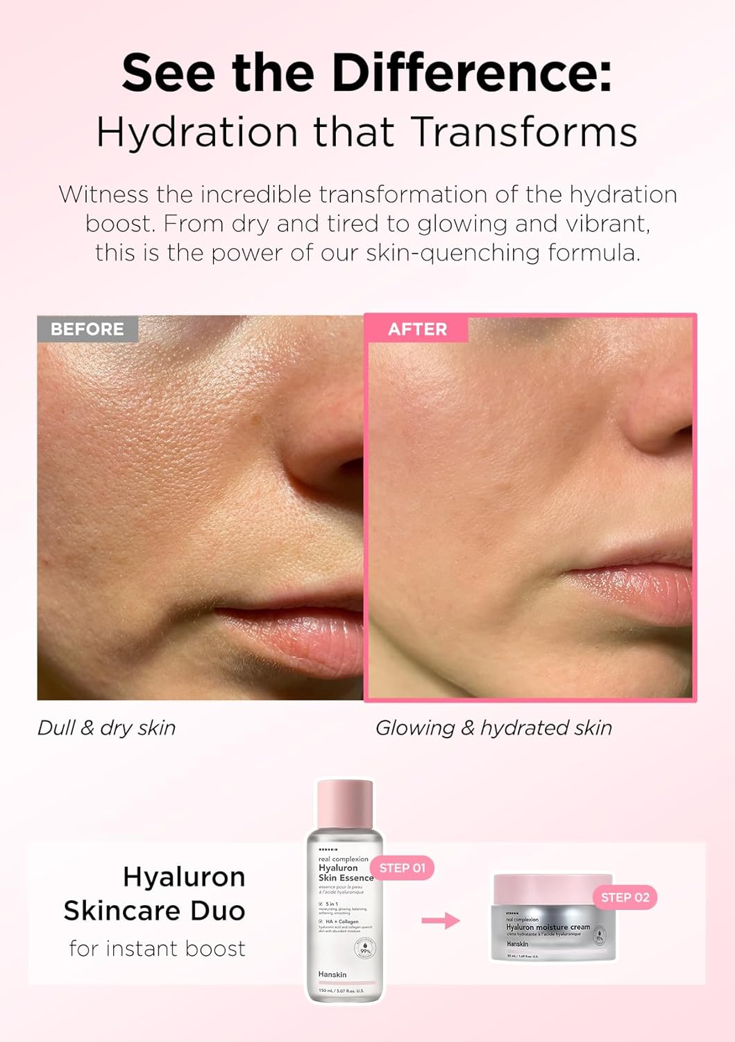 Hanskin Real Complexion Hyaluronic Moisture Cream,Hyaluronic Acid Moisturizer with Niacinamide Vitamin E Moisturizing Lotion for Sensitive and Dry Skin Korean Skincare 1.69 fl.oz. - Image 3