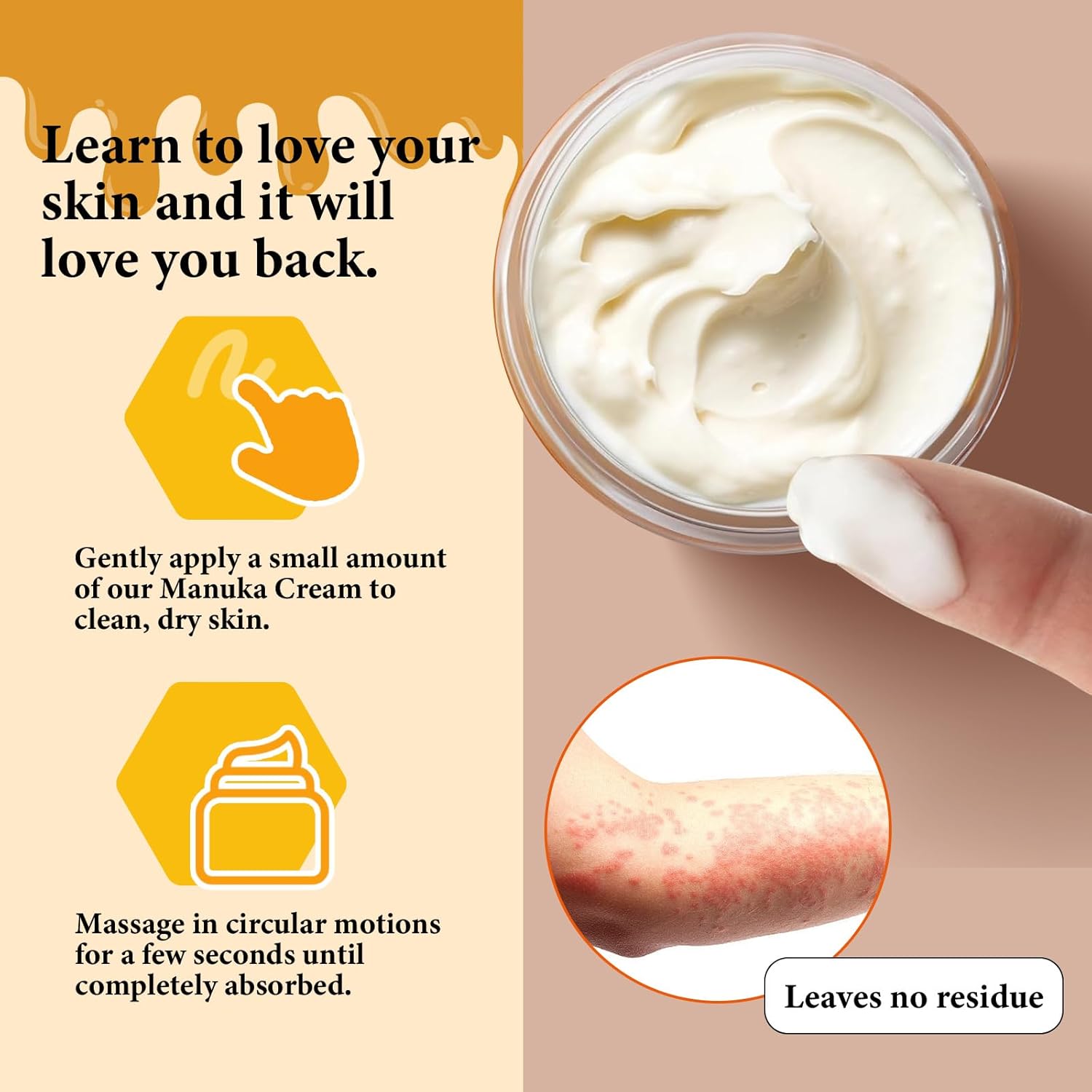 Organic Manuka Honey Eczema Cream for Soothing Relief of Dry, Itchy, Irritated Skin. - Image 7
