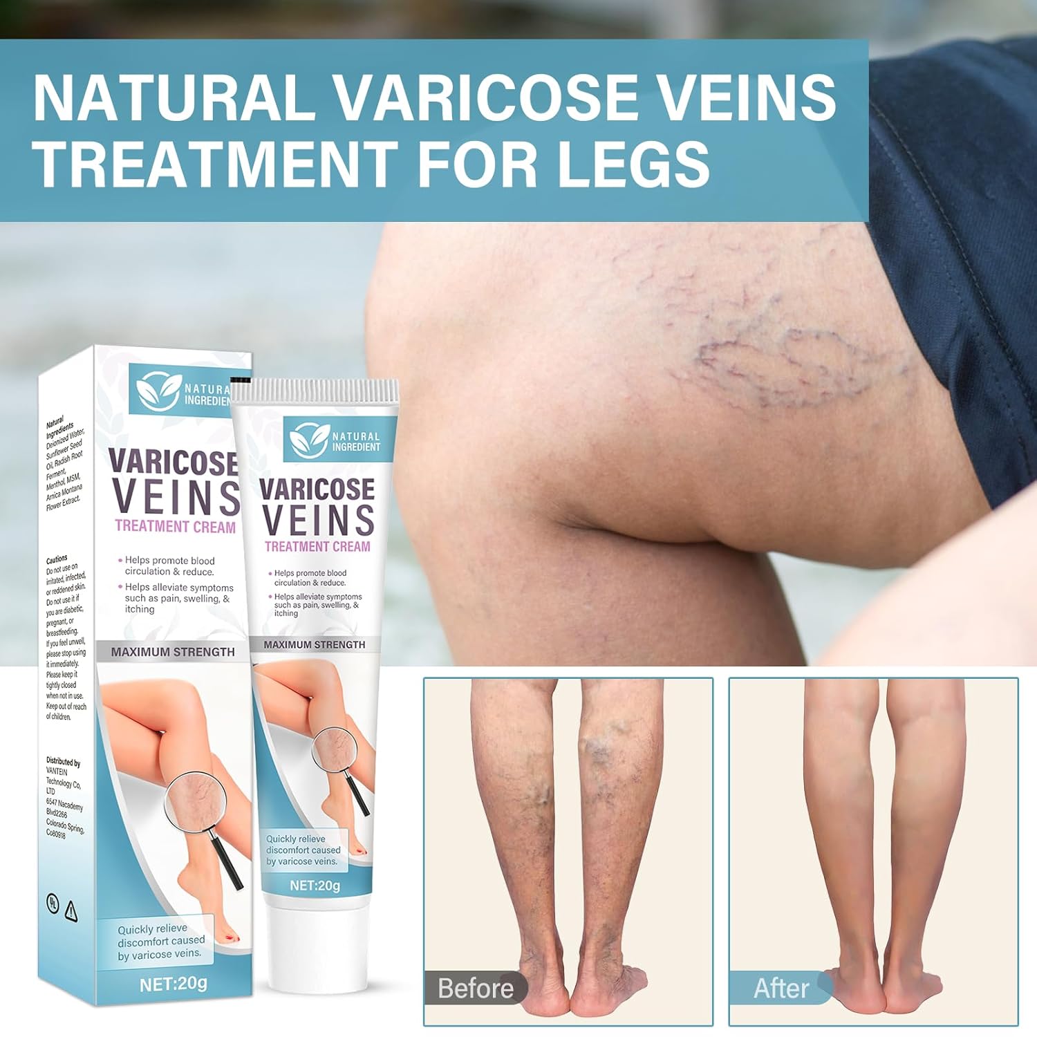 Varicose Veins Treatment for Legs, 2 Count Varicose Veins Cream - Improves Blood Circulation, Reduces Varicose Veins and Heaviness - Image 3
