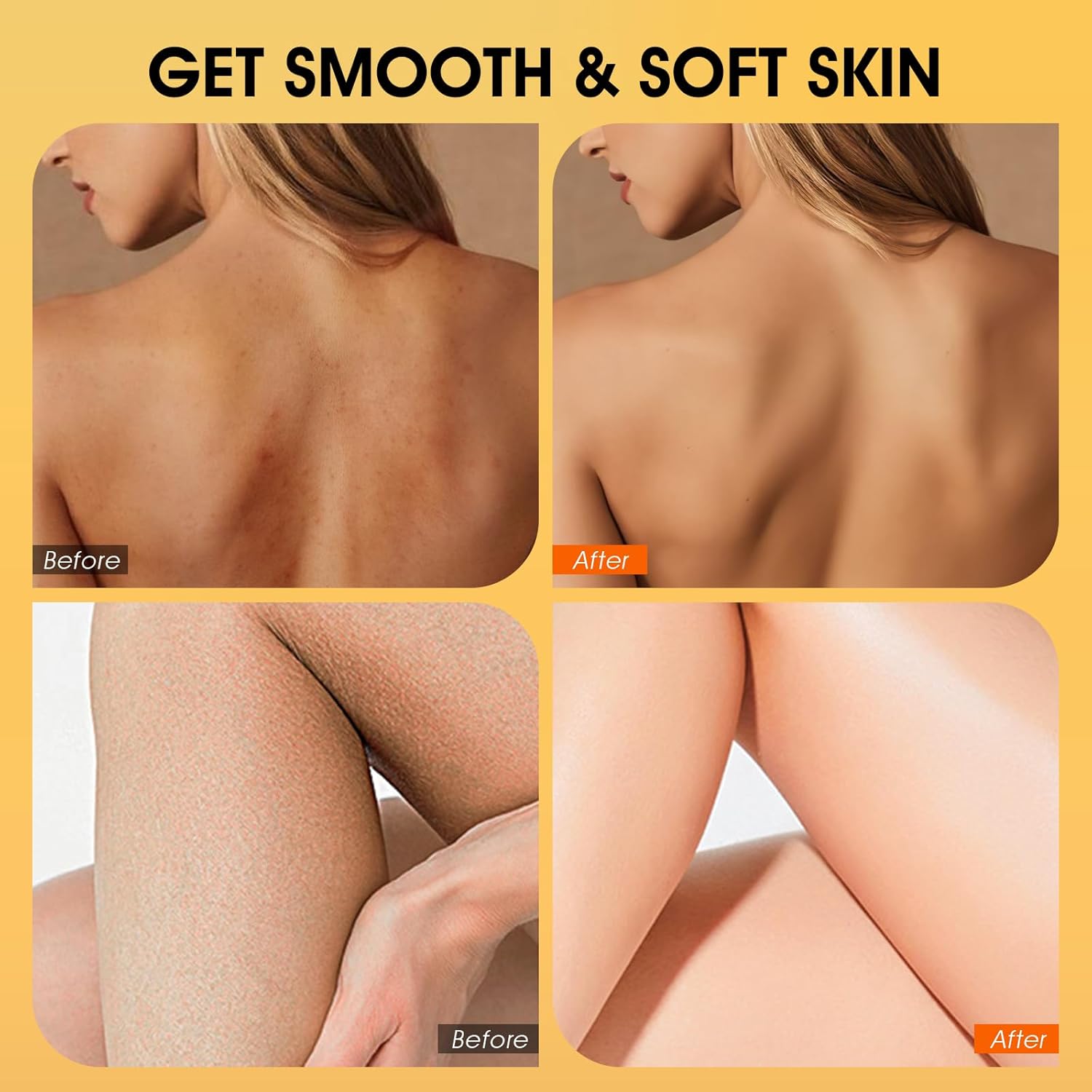 Body Scrub,Turmeric Exfoliating Body Scrub, with Coconut Oil & Vitamin C, Bikini Area Exfoliator Gently Exfoliate Body Hand and Foot Scrub, Moisturized Skin for Women and Men, 11.28oz/320g - Image 4