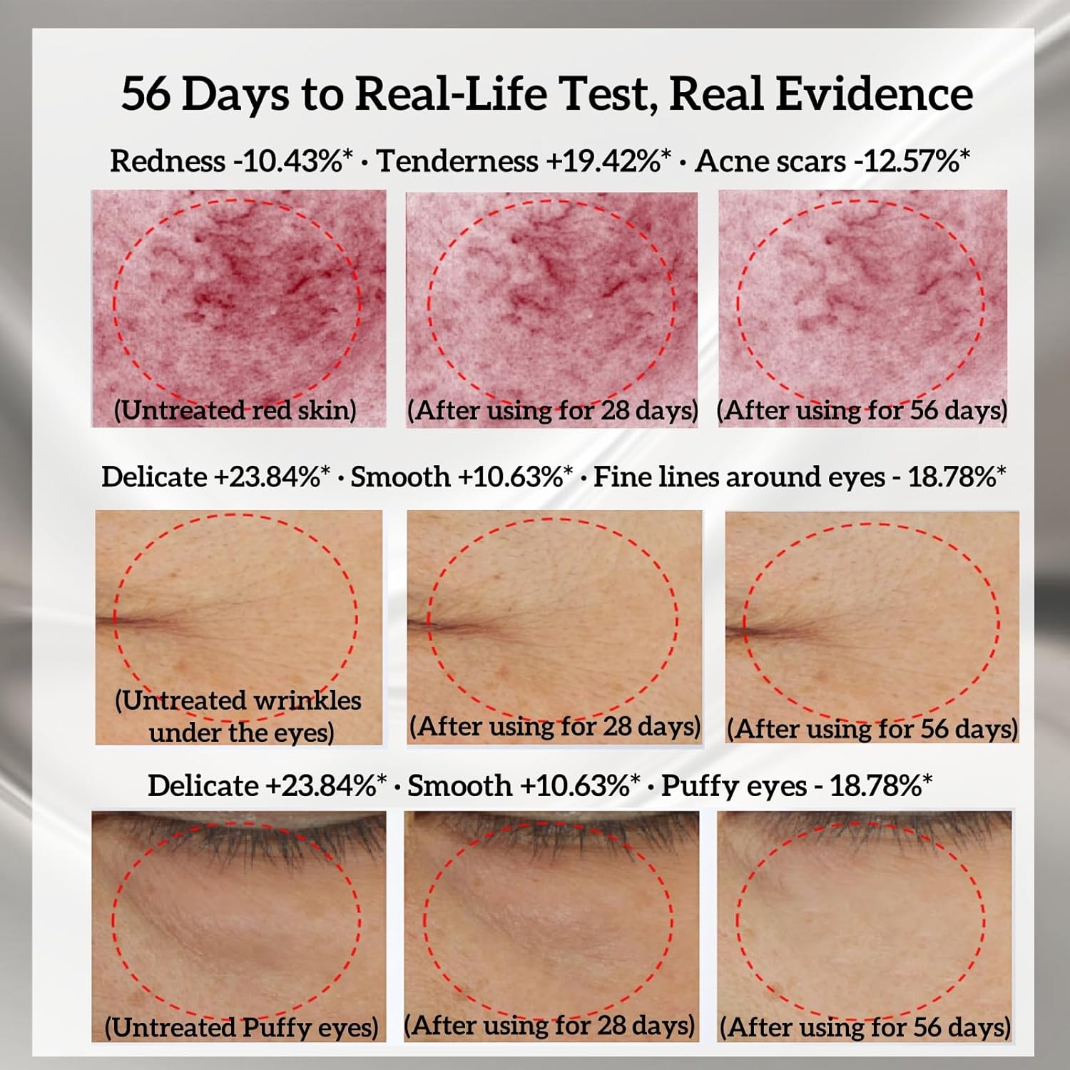 Double Effect 5-in-1Skin Firming Facial Device, Professional Home Beauty Device for Face and Body, 2025 New Upgrade 5 Energy Levels - Salon Results - Image 5