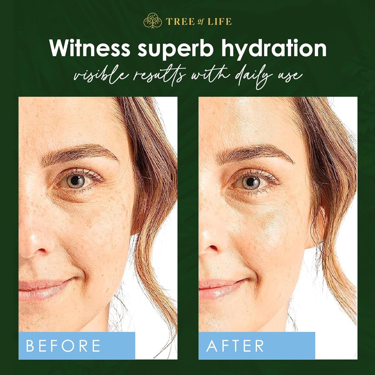 Tree of Life Beauty 2 Fl Oz Hyaluronic Acid Serum for Dark Spots and Dry Skin - Image 5