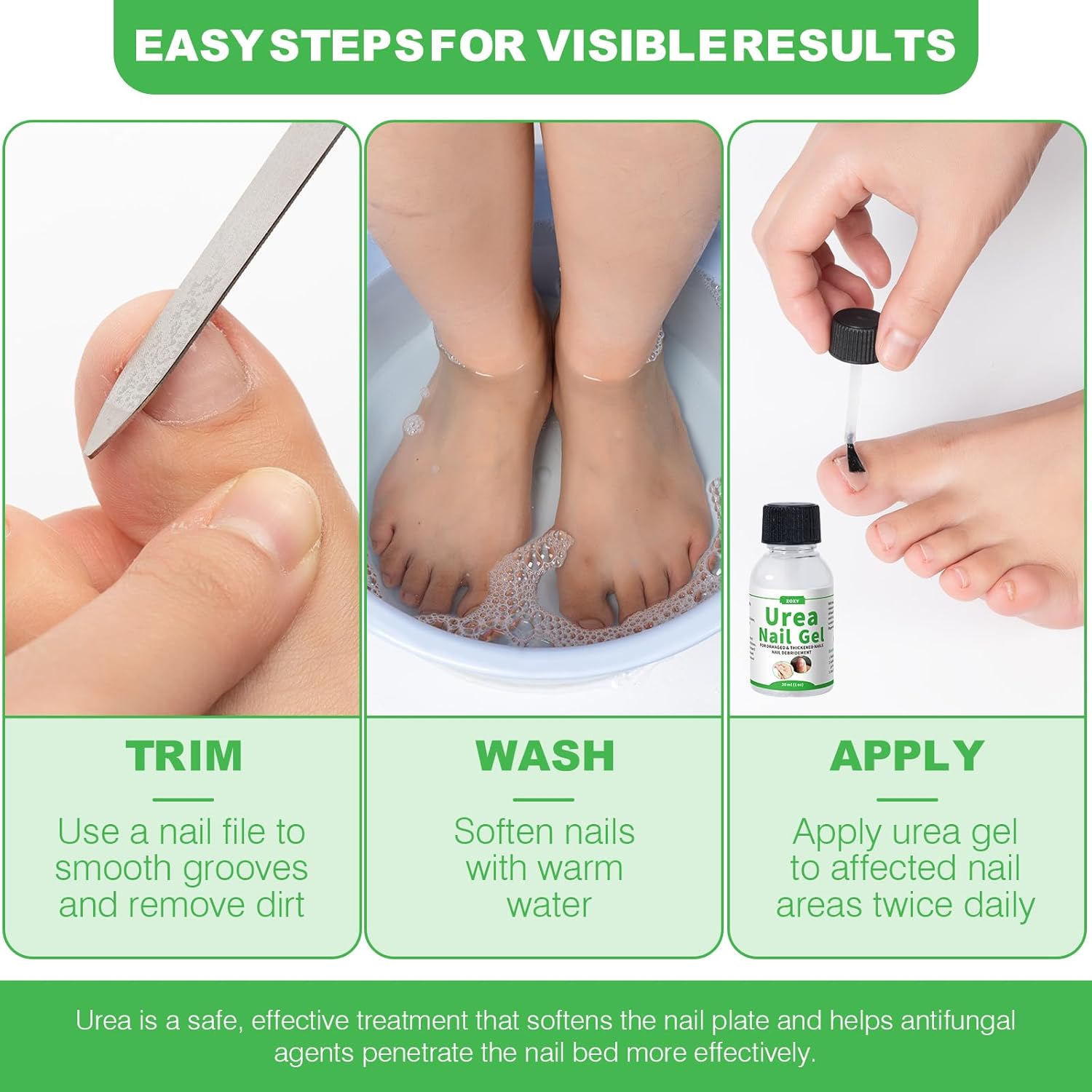 Urea Nail Gel 40% โ Softens Thick Nails & Calluses | Restores Discolored, Damaged Nails | Urea Gel for Nail, Fast-Absorbing - Image 6