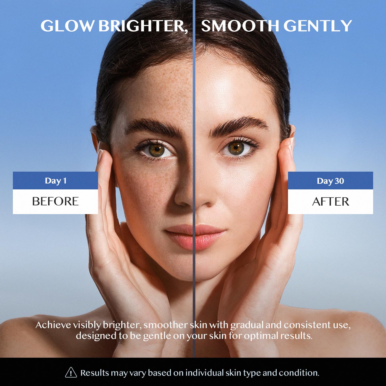 Dark Spot Remover for Face and Body: Dark Spot Corrector - Melasma, Freckle, Sun Spot, Age Spot Remover Advanced Formula for Women and Men(1.7 Fl Oz) - Image 4