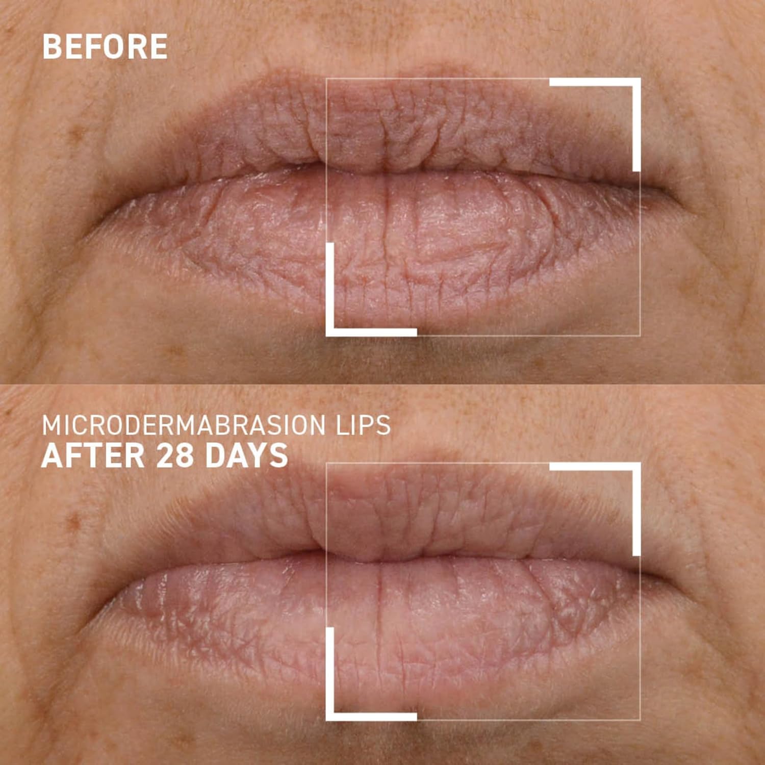 Dr. Brandt Microdermabrasion Lip Exfoliator 0.35 oz for Smooth, Renewed Lips - Image 3