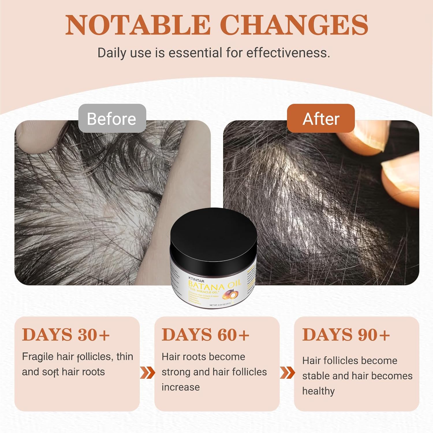 100% Natural Raw Batana Oil for Hair Growth Unrefined Organic 4.23 Fl Oz Pack of 1 - Image 4