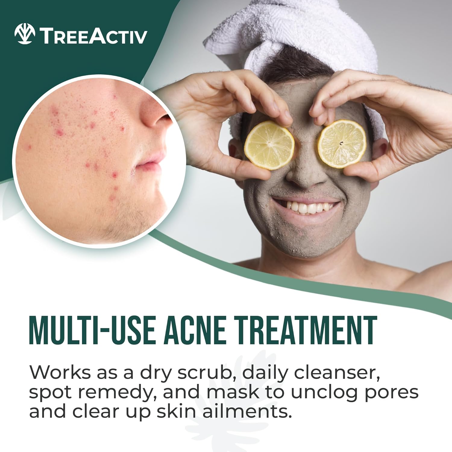 TreeActiv Four-in-One Acne Treatment | Wash, Scrub, Mask, and Spot Treatment | Heals Rosacea | Exfoliating Sugar | Face or Body | Natural Sulfur Clear Skin Cleanser | Bentonite (4 Ounce) - Image 2