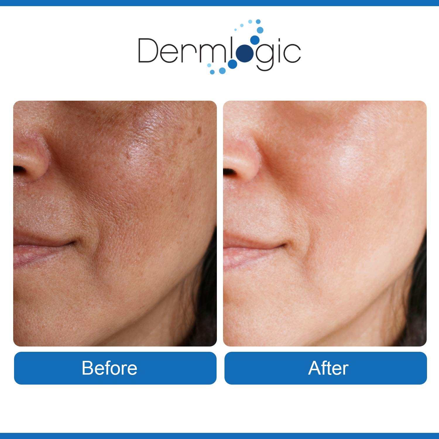 Triple Action Anti-Aging Resurfacing Peel Pads with Glycolic, Lactic, Salicylic Acids - 30 Count - Image 3