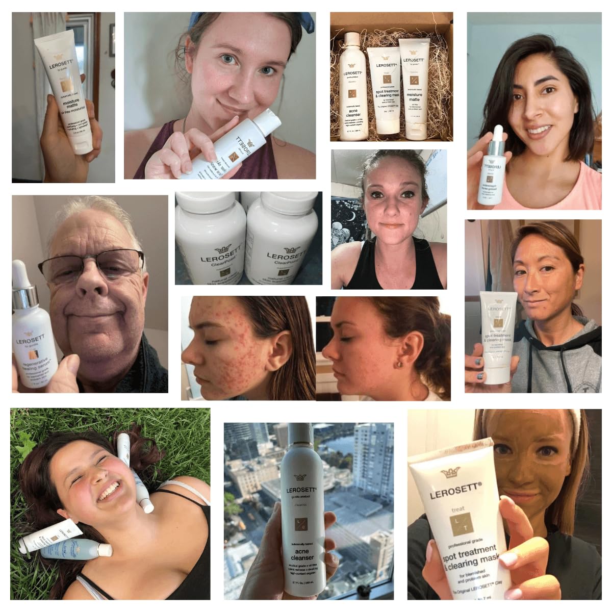 LEROSETT Oil-Free Moisturizer for Acne, Moisture Matte for Oily & Sensitive Skin, Vegan Moisturizer, Lightweight & Aloe-Based with Vit-B5 + 7 Soothing Herbals, Non-comedogenic, Fragrance Free - 3 oz - Image 9