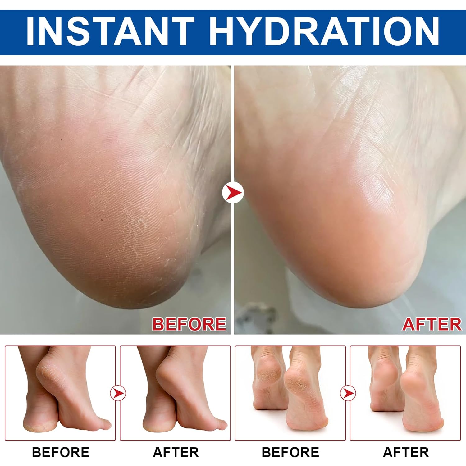 Urea Cream Stick 60% with 2% Salicylic Acid, 2.5 oz Moisturizing Lotion for Dry Feet - Image 7