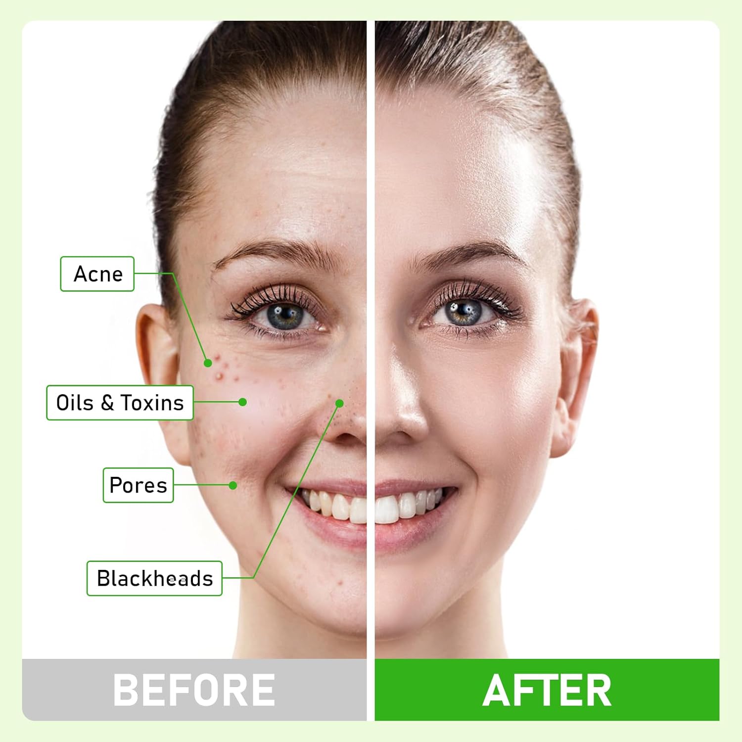 Dead Sea Mud Mask with Tea Tree Oil for Face and Body 5.29oz Deep Cleansing - Image 4
