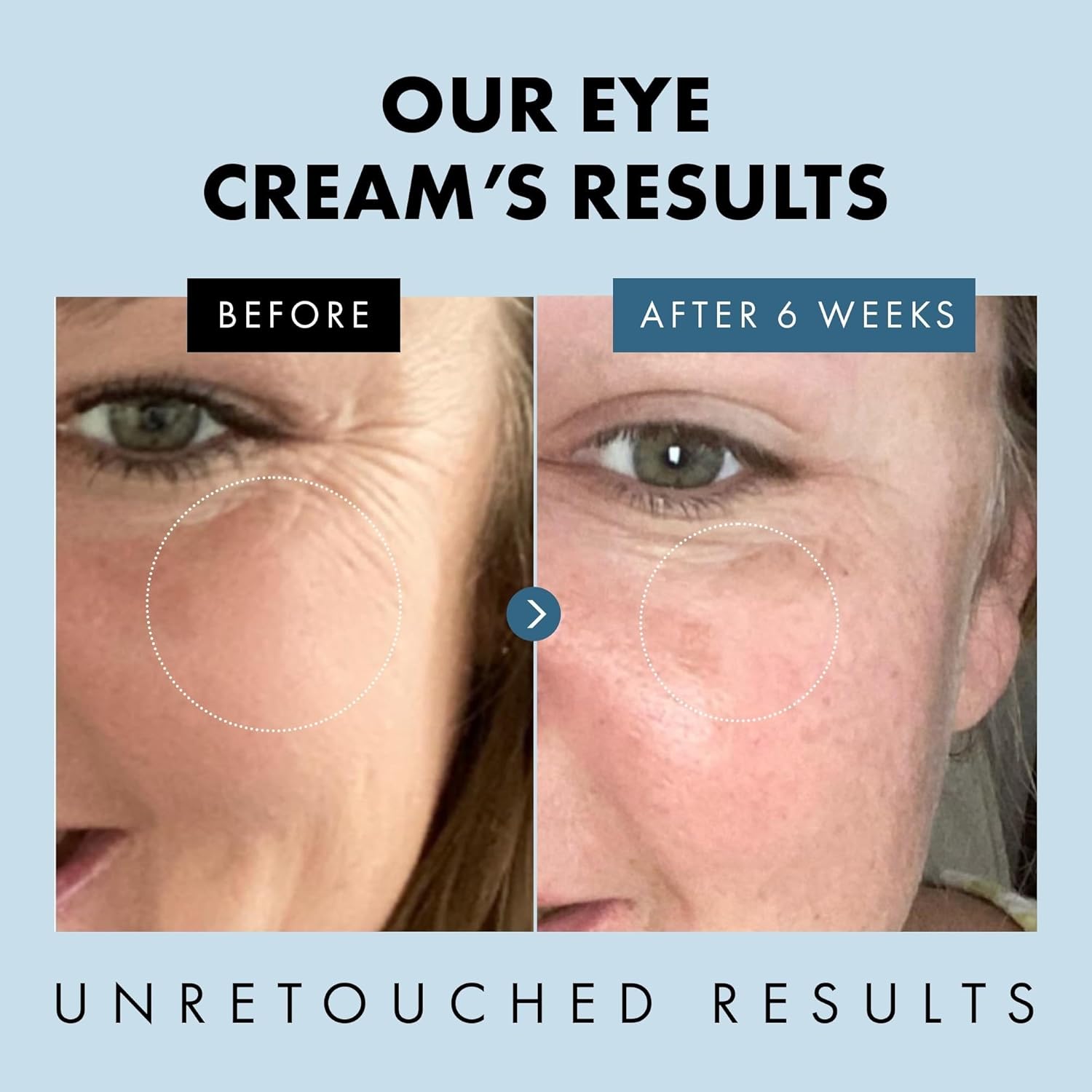 Eclat Skincare Under Eye Cream for Dark Circles & Puffiness – Anti Aging Formula for Wrinkles - Moisturizer for Fine Lines, Crows Feet & Eye Bags – Hydrating Treatment for Firming & Smoothing 30ml - Image 3