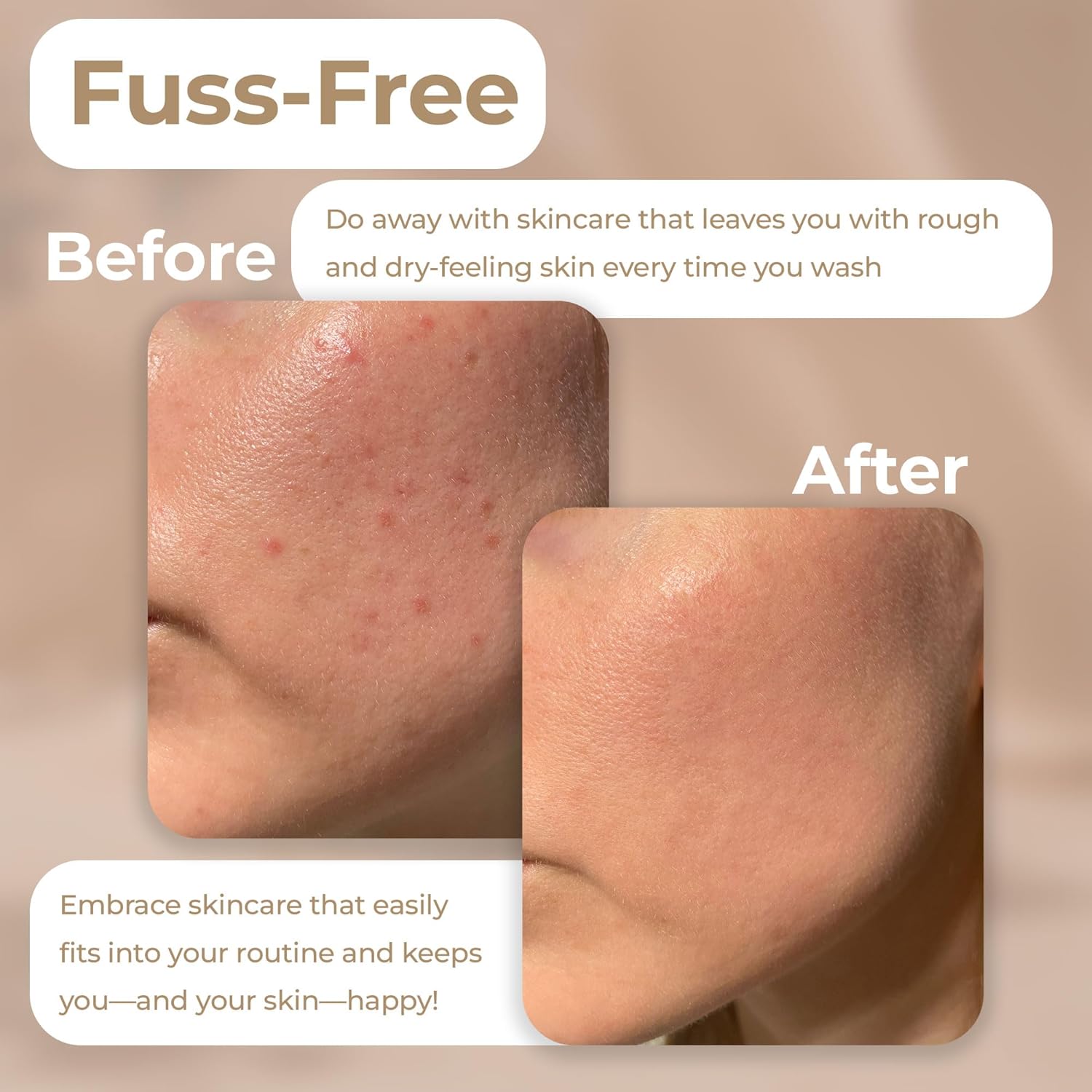 Vivo Per Lei Facial Peeling Gel - Contains Dead Sea Minerals and Nut Shell Powder - Gentle Face Exfoliator Scrub and Blackhead Remover - Peel Your Skin to a Fresher You - 3.4 Fl. Oz. - Image 4