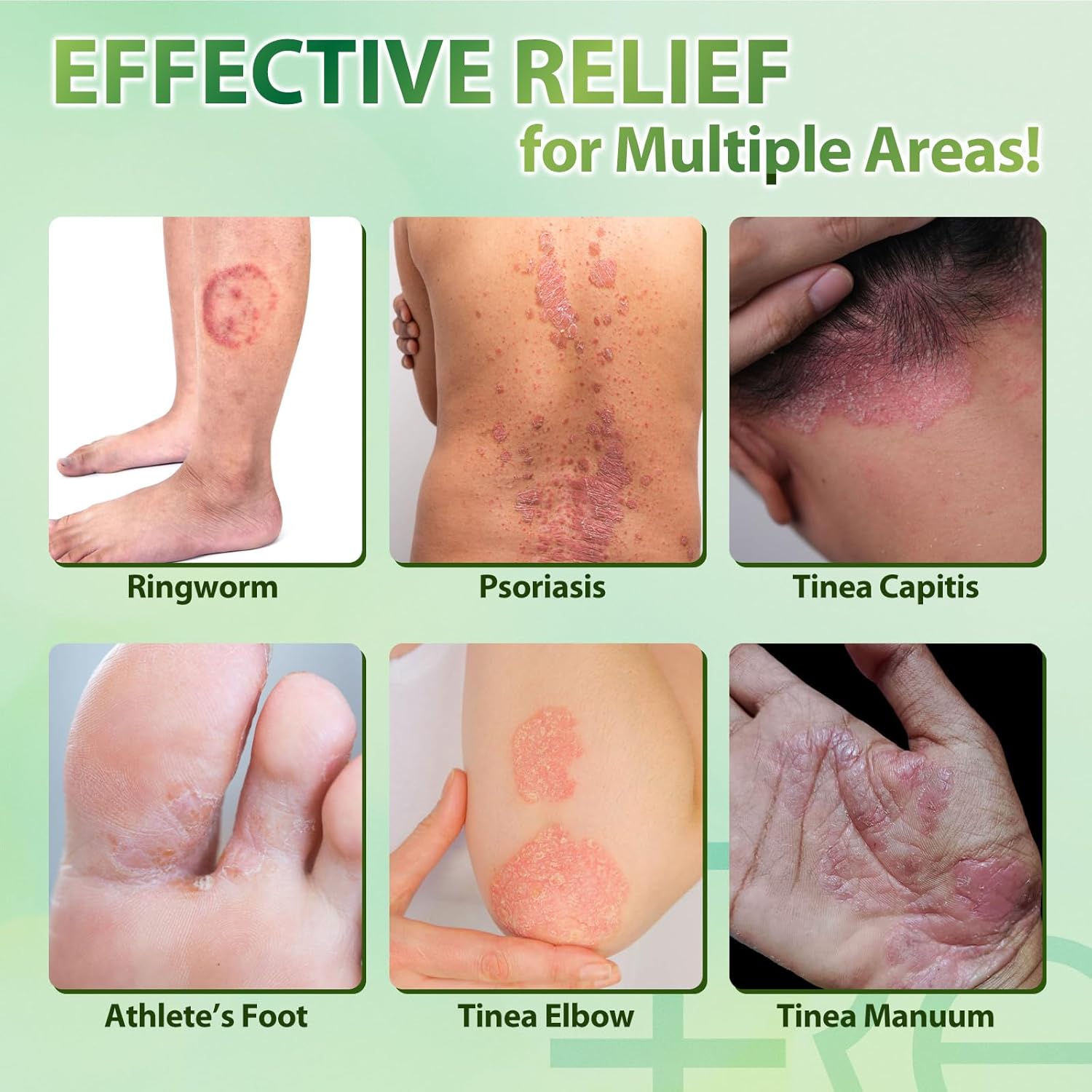 4 oz Natural Antifungal Cream for Jock Itch, Athlete's Foot, Ringworm with Tea Tree, Aloe, Lavender - Image 5