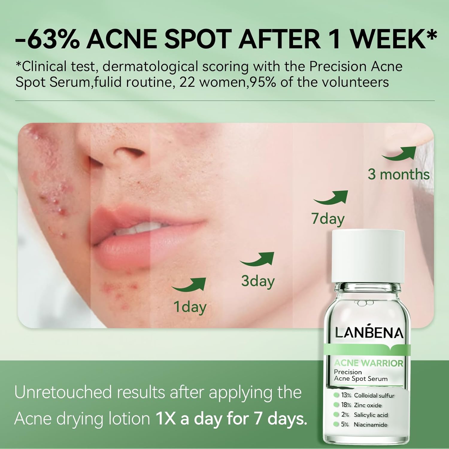 LANBENA Precision Acne Spot Serum, Acne Drying Lotion, Overnight Acne Treatment For Face, Dry Out Pimples, Blemishes, Zits And Clean Pores, 0.42 Fl Oz - Image 4
