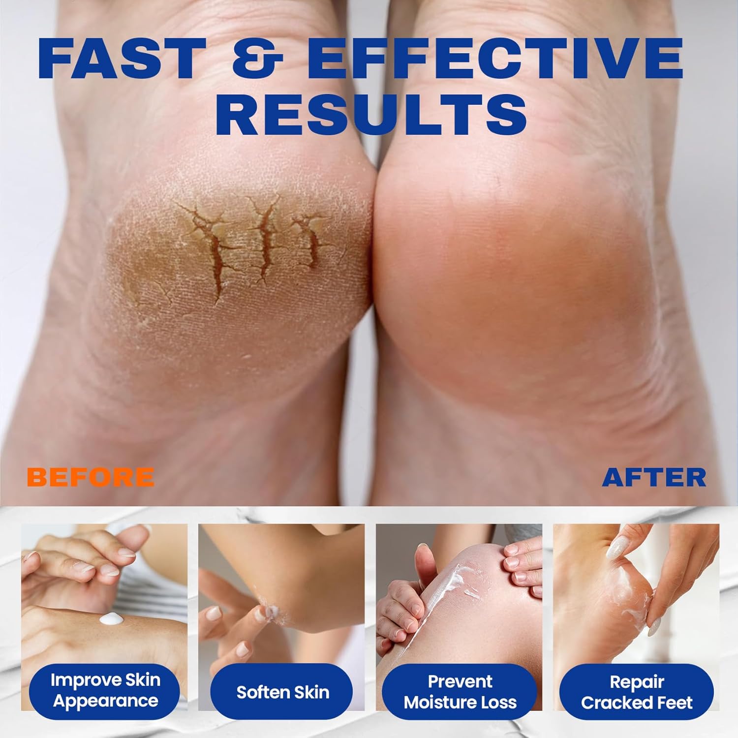 Urea Cream 40 percent for Feet with 2% Salicylic Acid, Maximum Strength & Intensive Repair Care for Dry Cracked Heels, Relief for Dry Foot, 5.29 OZ - Image 3
