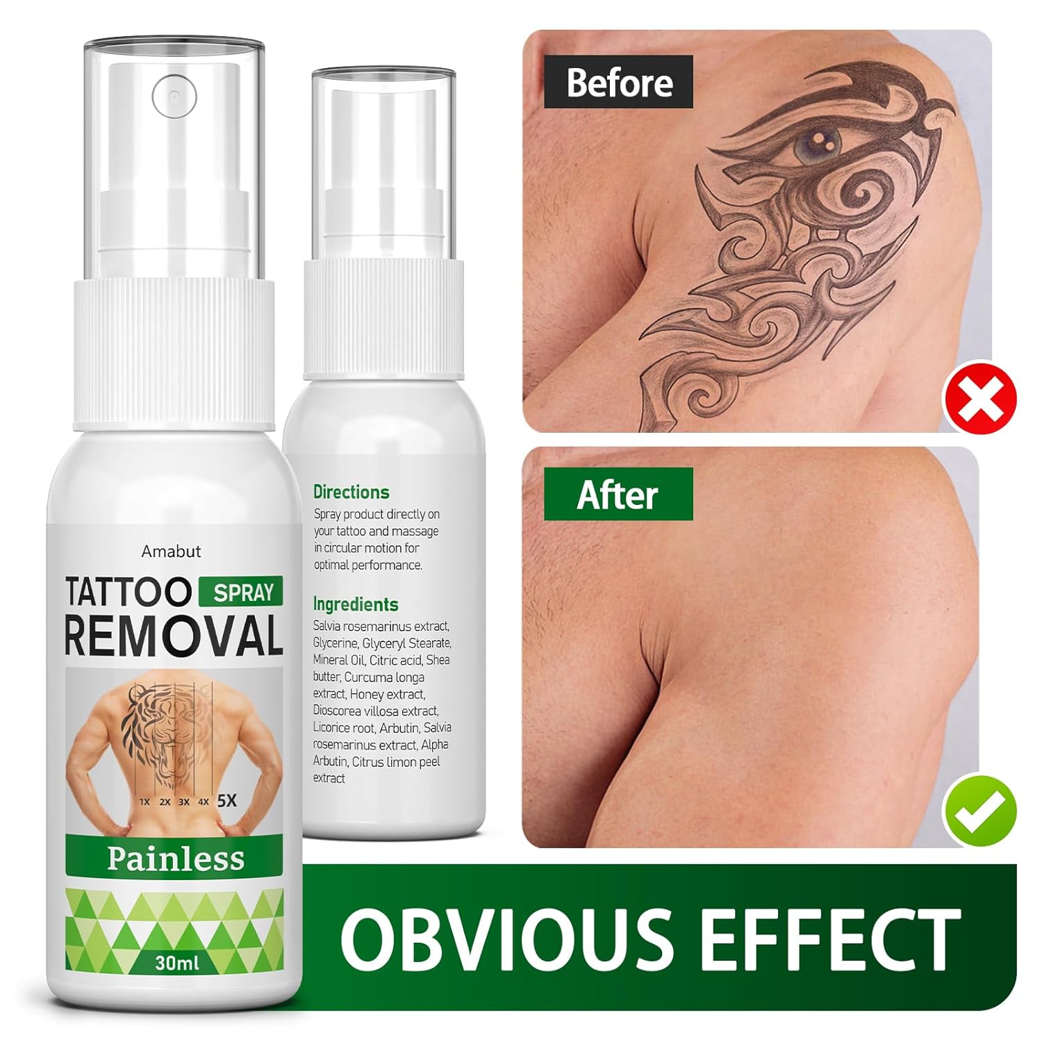 Tattoo Remover-Tattoo Removal Cream That Works, Painless Tattoo Fade Cream for Men & Women-Quick Absorption & No Scars Left, Natural Ingredients, 1 fl oz (30ml) - Image 2