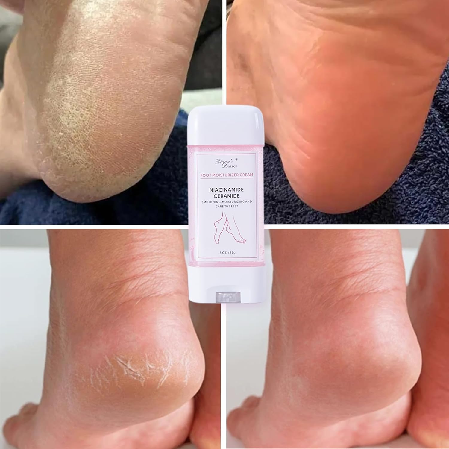 DIANA'S DREAM Foot Cream Foot Moisturizer, Dry|Cracked Foot Repair Ultra-Hydrating Foot Cream Moisturizer, Foot Repair Skin Healing Ointment for Cracked Heels and Dry Feet, 3 Oz - Image 5
