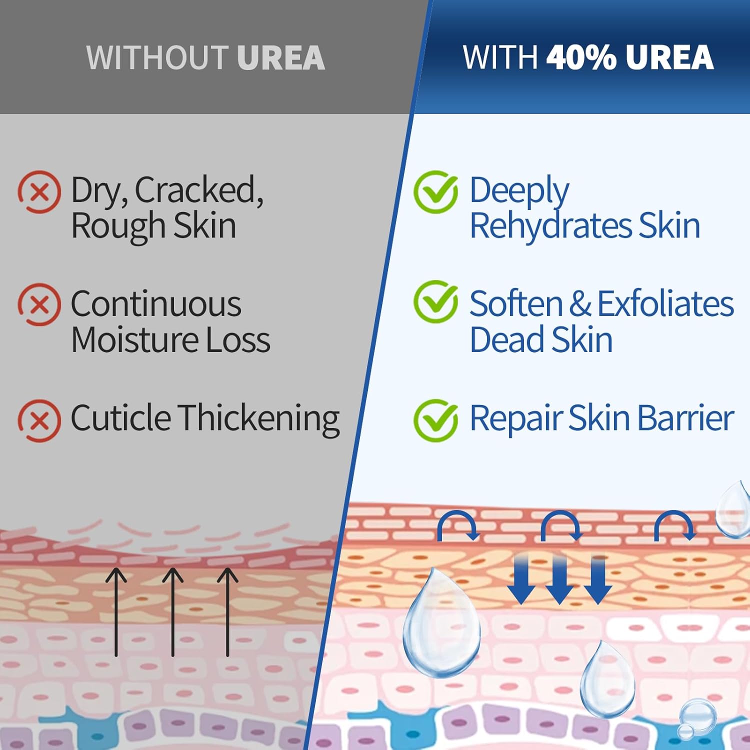 Urea Cream 40 Percent for Feet Maximum Strength, with 2% Salicylic Acid Urea Foot Cream for Dry Cracked Heels and Feet, Tea Tree Oil Foot Cream for Corn and Callus Remover (8.8Oz) - Image 4