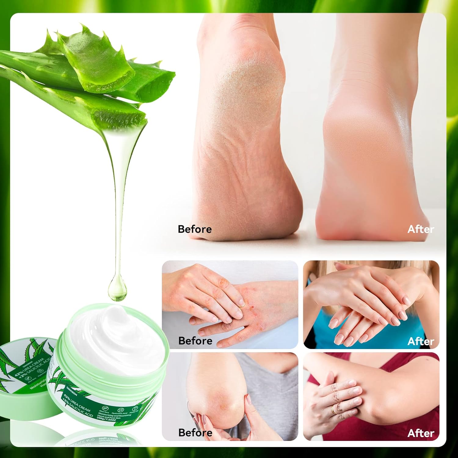 Urea Cream 42 Percent for Feet 7.0 Oz, 2% Salicylic Acid, Aloe Vera, Hyaluronic Acid , Deeply Moisturize Skin Cream For Dry Cracked Feet, Hands, Heels, Elbows, Nails, Knees, Intensive Moisturizes & - Image 5