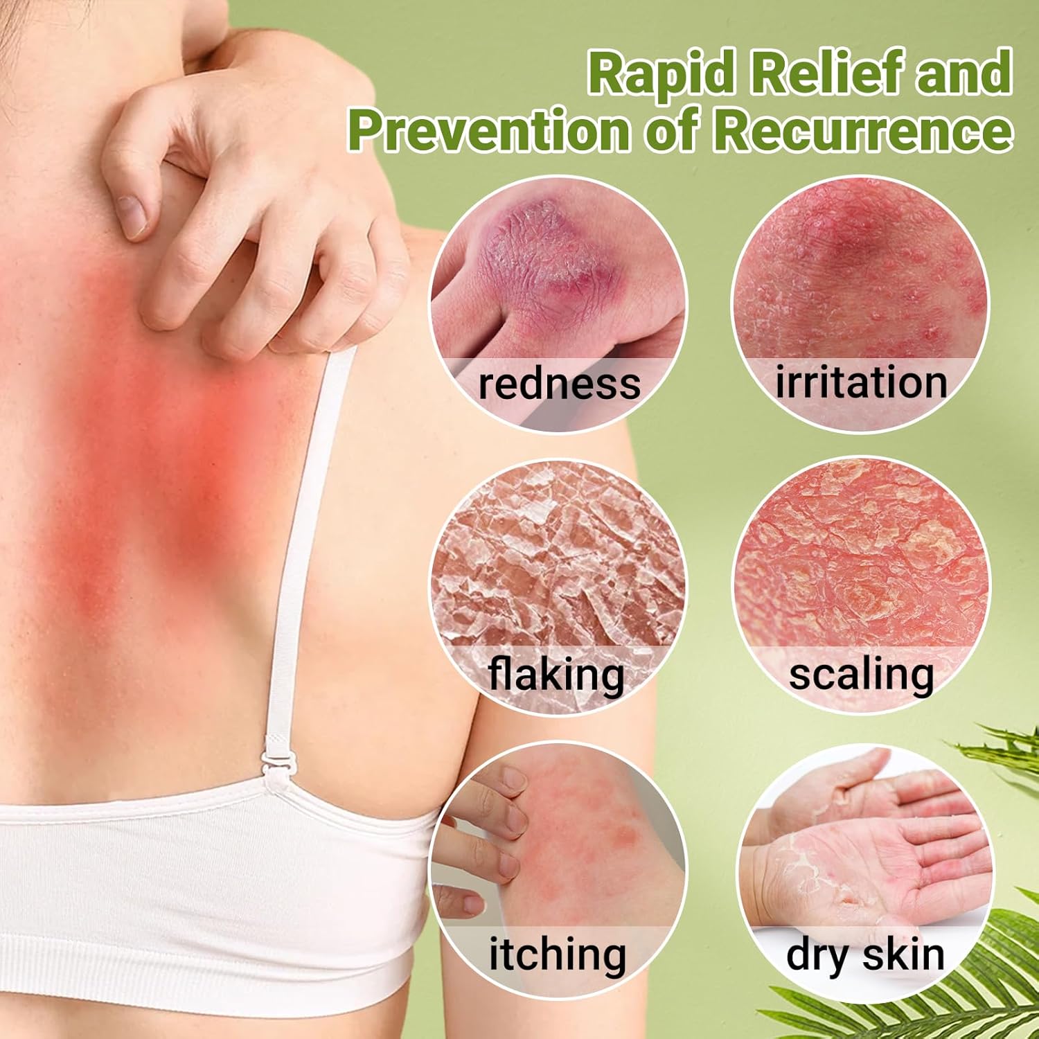 Maximum Strength Psoriasis Cream 3.53 oz Moisturizing Treatment for Itch Redness Flaking - Image 3