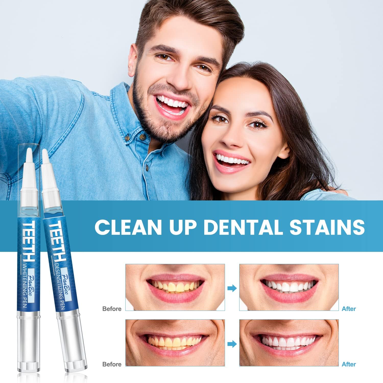 Teeth Whitening Pen 4+1(5 Pack), 70+ Treatments, Use Twice a Day Up to 1-6 Shade Whiter in 1-2 Weeks, 4 Whitening Pens plus 1 Desensitizing Pen, Effective, Painless and Enamel Safe Teeth Whitening Gel - Image 2