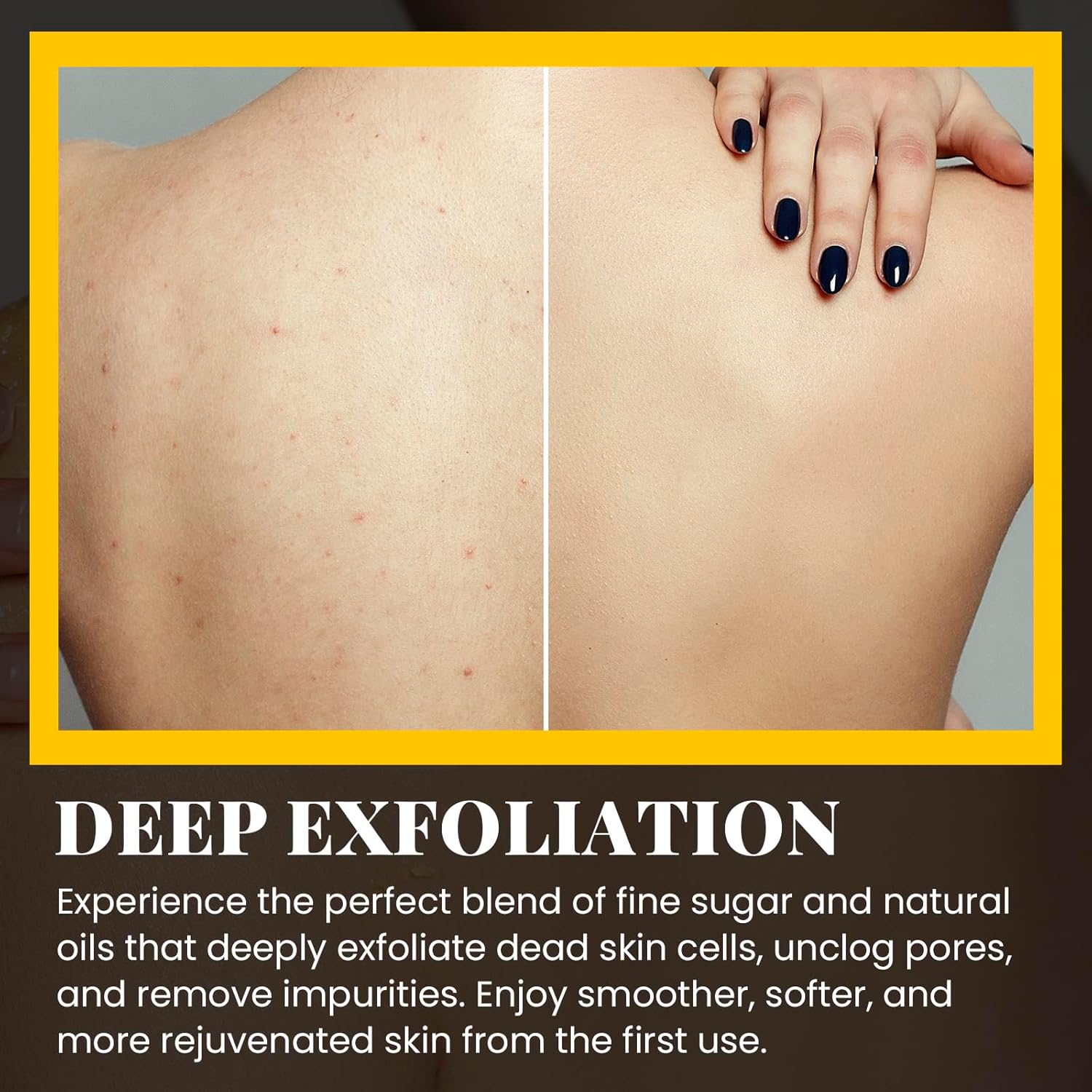 Turmeric Natural Glow Body Scrub Exfoliator for Dark Armpits Inner Thighs 8 oz - Image 5