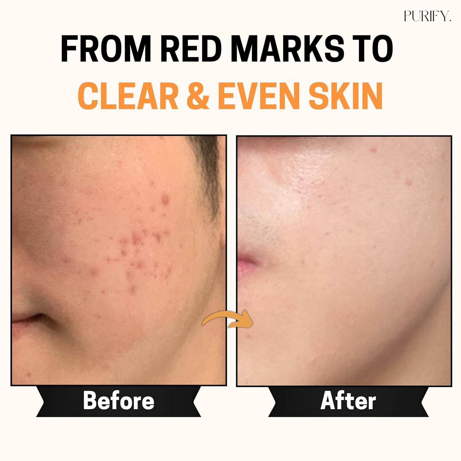 Purify 20% Vitamin C Serum - with Vitamin E & Ferulic Acid - Anti Aging - Brightening Face Serum - Pure Vit C for Dark Spots Correcting, Uneven Skin Tone, Wrinkles, Glow - 1 fl oz. - Image 2