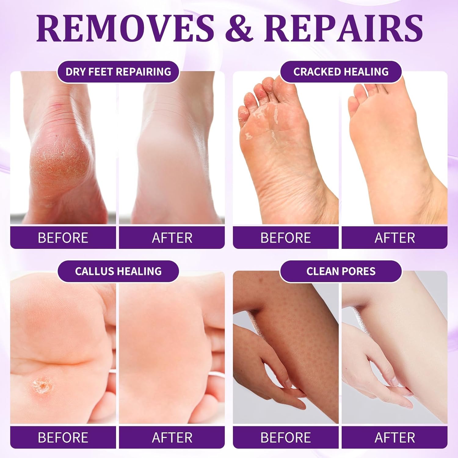 Lavender 4-Step Pedicure Kit 16 oz Foot Soak Scrub Mask Lotion - Image 3