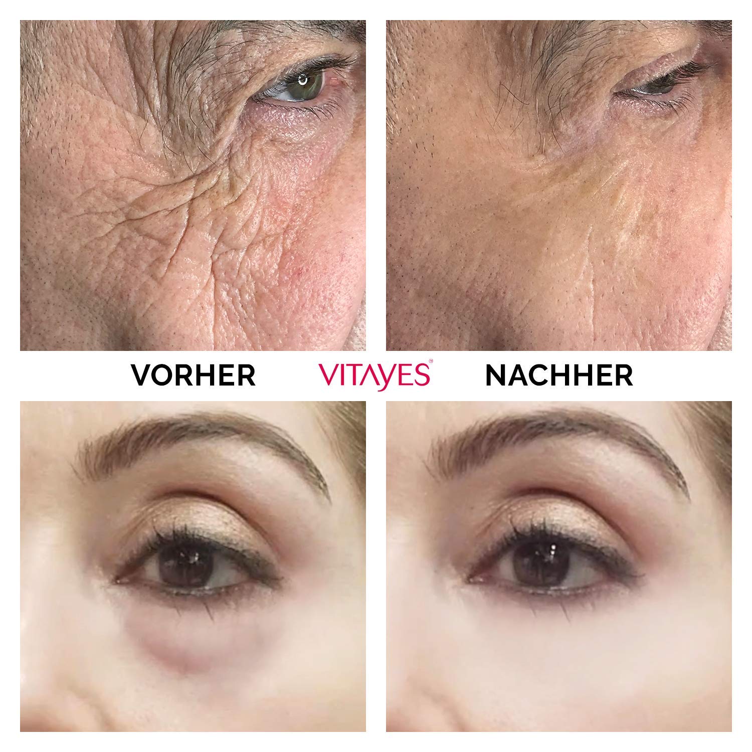 VITAYES Instant Ageback Lifting Cream 0.24 Oz for Dark Circles and Wrinkles - Image 3