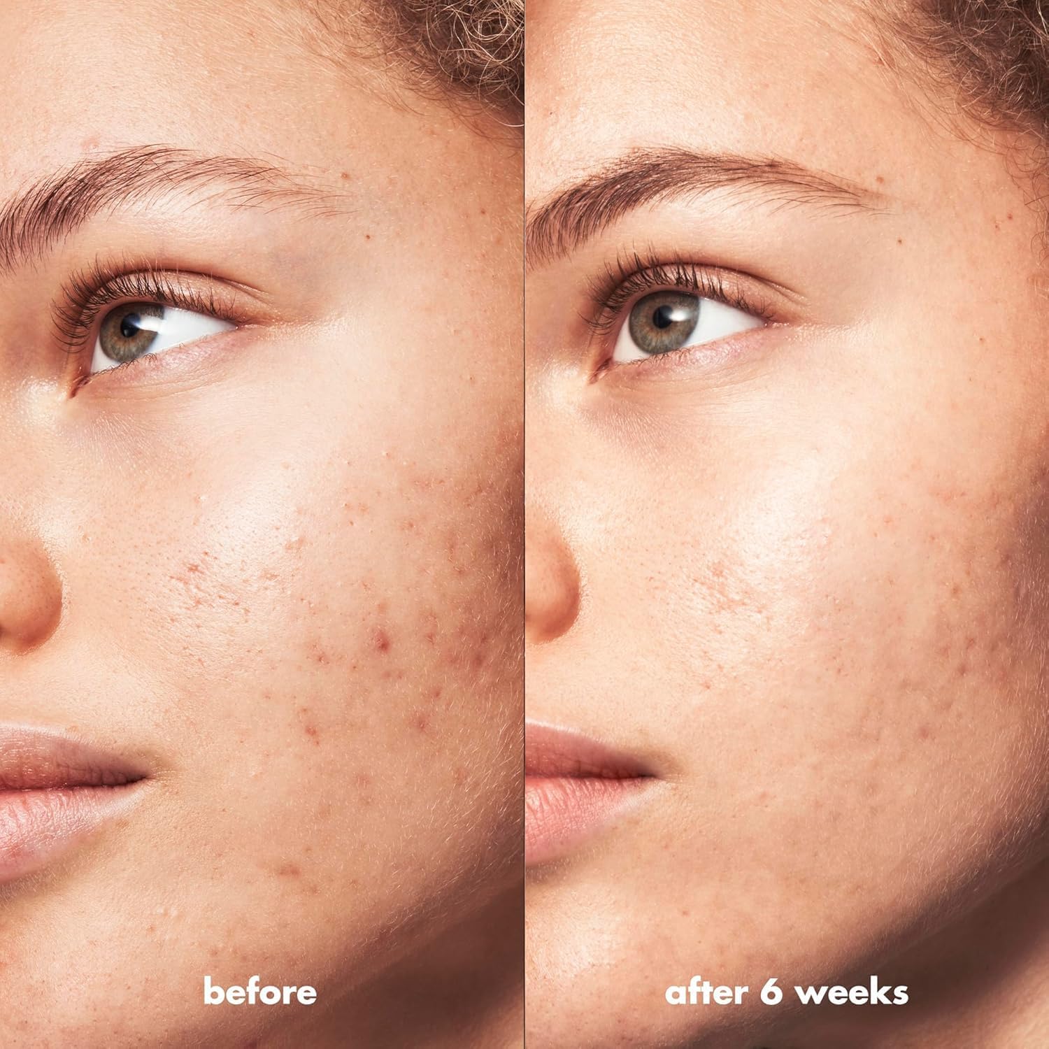e.l.f. SKIN Blemish Breakthrough Calming Water Cream Mini, Lightweight Blemish-Fighting Face Moisturizer, Prevents New Blemishes & Calms Skin - Image 5