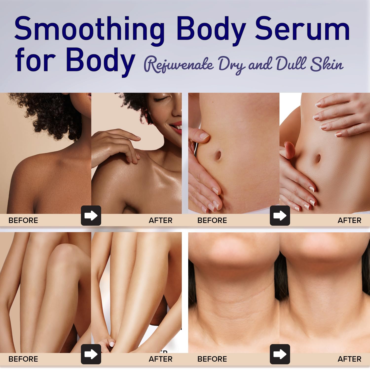Enaskin Naturals Smoothing Body Serum Lotion for Dry and Crepe Skin: Anti-Wrinkle, Hydrating, Firming with Hyaluronic Acid & Niacinamide, Non-Greasy, for All Skin Type - Image 2