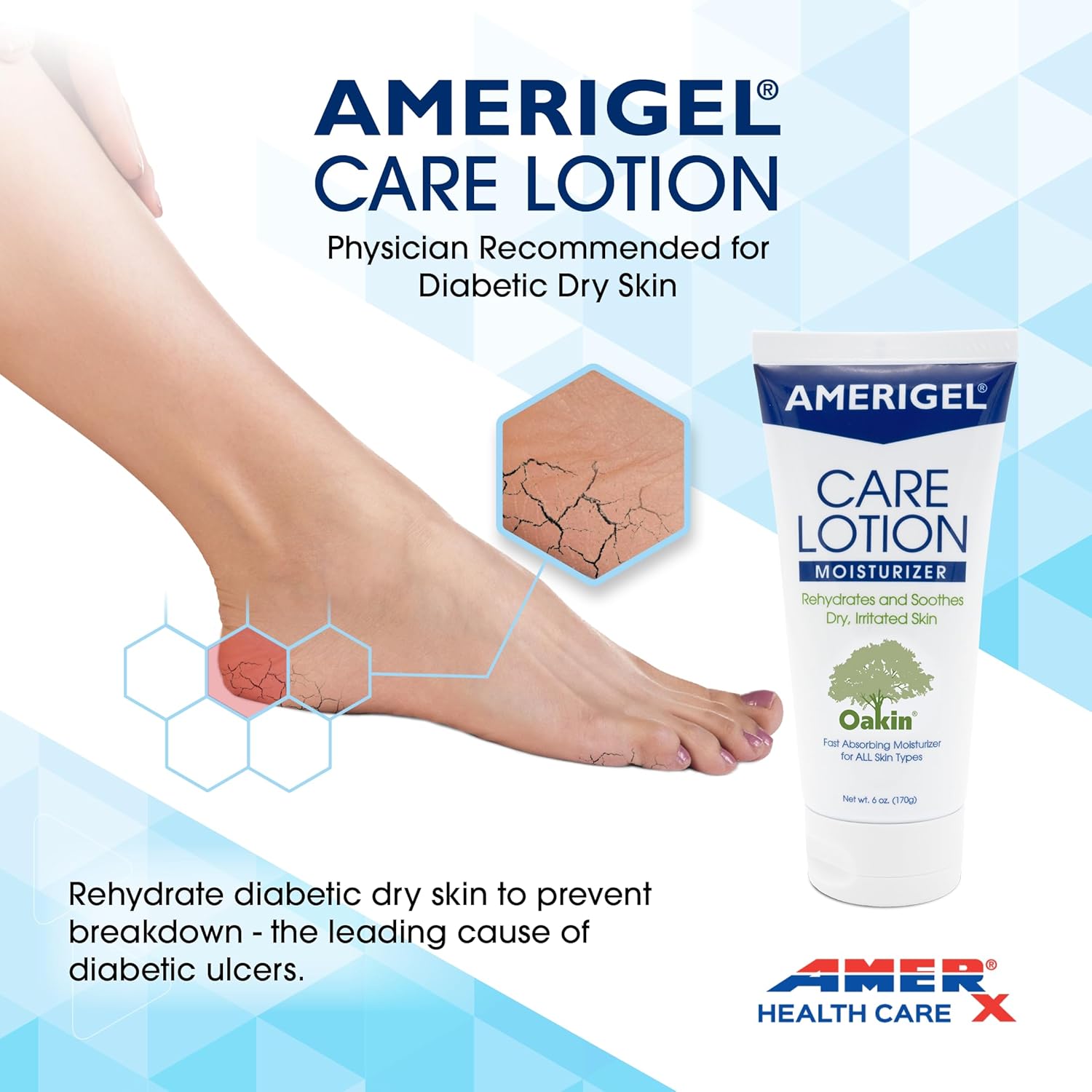 AMERIGEL Care Lotion 6 oz Hypoallergenic Moisturizer for Diabetic and Dry Skin - Image 4