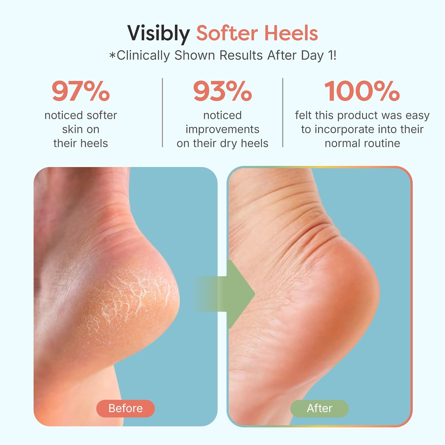 ZenToes Wide Width Fuzzy Blue Moisturizing Socks for Cracked Heels with Vitamin E Jojoba Oil - Image 3